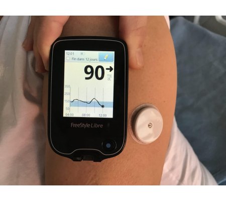 Webinaire Diabète de type 2 : les messages-clés sur l’utilisation des capteurs